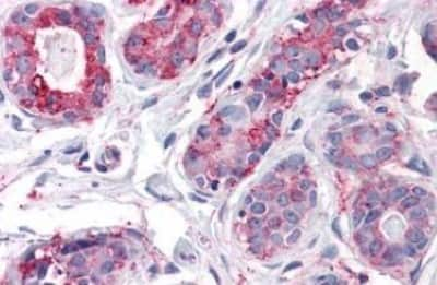 Immunohistochemistry-Paraffin: CD39L1/ENTPD2 Antibody [NBP3-14293] - CD39L1/ENTPD2 antibody IHC of human breast. Immunohistochemistry of formalin-fixed, paraffin-embedded tissue after heat-induced antigen retrieval.